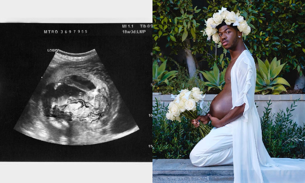 Lil Nas X 懷孕了？！IG 大曬「凸肚照」：這是我的寶貝！
